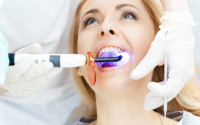 Blanqueamiento Dental: Qué es y qué tipos hay