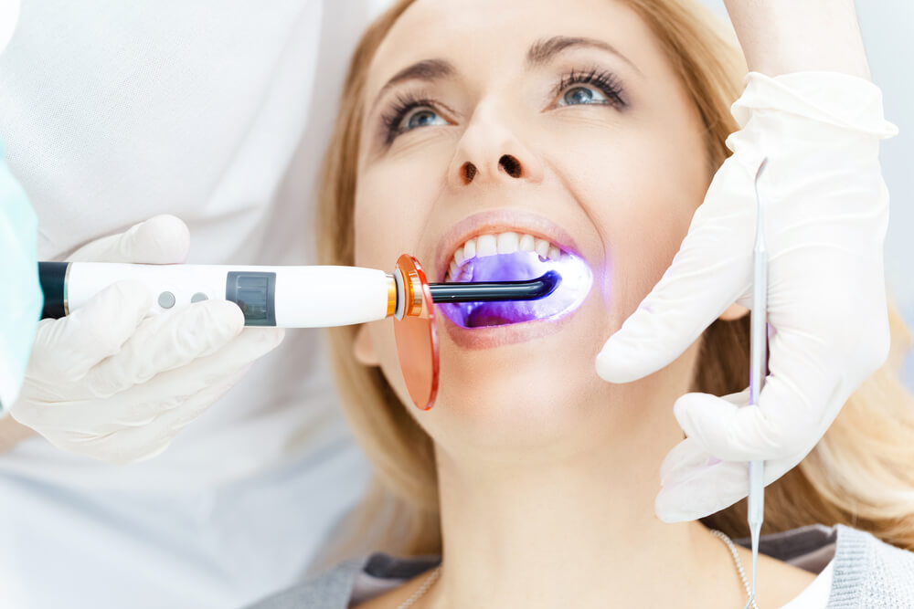 Dentista blanqueamiento dental