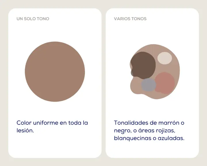 Regla ABCDE: lunar de un solo tono frente a lunar con varios tonos